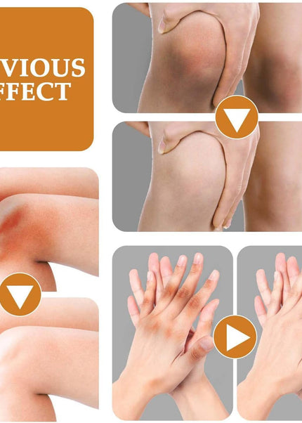 Jaysuing Dark Spot Correcting Cream with Brighten Skin Removes Sunburn Spots